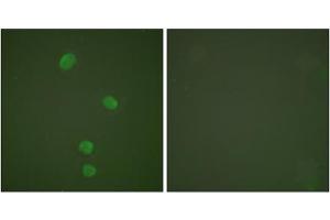 Immunofluorescence analysis of HepG2 cells, using MCM5 antibody (ABIN5976453). (MCM5 anticorps  (N-Term))