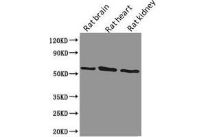 Western Blot Positive WB detected in: Rat brain tissue, Rat heart tissue, Rat kidney tissue All lanes: PODXL antibody at 1.