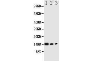 Western Blotting (WB) image for anti-Interleukin 4 (IL4) (AA 72-88), (Middle Region) antibody (ABIN3044141)