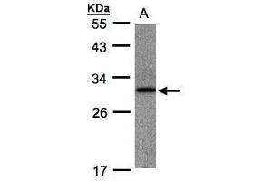 WB Image Sample(30 ug whole cell lysate) A:Raji , 10% SDS PAGE antibody diluted at 1:1000 (ANKRD7 anticorps)