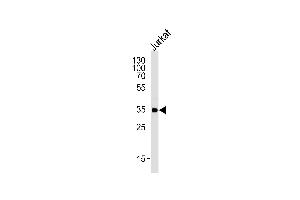 Western blot analysis of lysate from Jurkat cell line,using FCGR2A Antibody (C-term) (ABIN652864 and ABIN2842562).