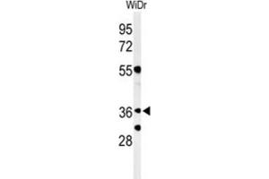 Western Blotting (WB) image for anti-Non-SMC Element 4 Homolog A (NSMCE4A) antibody (ABIN3004373) (NSMCE4A anticorps)