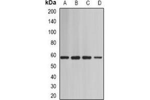 Western blot analysis of BAF60A expression in Jurkat (A), mouse heart (B), mouse testis (C), rat brain (D) whole cell lysates. (SMARCD1 anticorps)