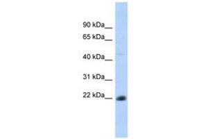 Image no. 1 for anti-CD40 (CD40) (AA 35-84) antibody (ABIN6740742) (CD40 anticorps  (AA 35-84))