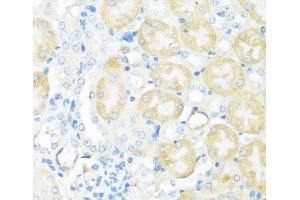Immunohistochemistry of paraffin-embedded Mouse kidney using NRF2 Polyclonal Antibody at dilution of 1:100 (40x lens). (NRF2 anticorps)