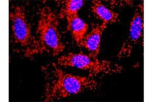 Proximity Ligation Analysis of protein-protein interactions between TGFB1 and APP.
