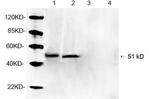 Western blot analysis of tissue lysates using 1 µg/mL Rabbit Anti-Parkin Polyclonal Antibody (ABIN398785) Lane 1, 3: Mouse brain tissue lysateLane 2, 4: Rat brain tissue lysate Primary antibody: Lane 1, 2: Rabbit Anti-Parkin Polyclonal AntibodyLane 3, 4: Rabbit Anti-Parkin Polyclonal Antibody pre-incubated with immunizing peptideThe signal was developed with IRDyeTM 800 Conjugated Goat Anti-Rabbit IgG. (Parkin anticorps  (AA 300-350))