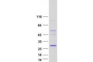 Validation with Western Blot