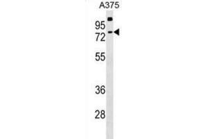 Western Blotting (WB) image for anti-Transketolase-Like 2 (TKTL2) antibody (ABIN2999404) (TKTL2 anticorps)
