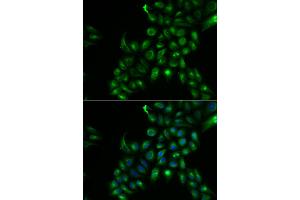 Immunofluorescence analysis of U2OS cells using TSPAN7 antibody. (Tetraspanin 7 anticorps)