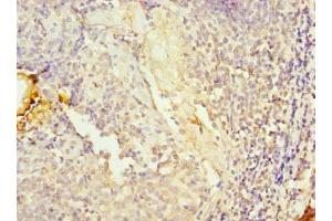 Immunohistochemistry of paraffin-embedded human tonsil tissue using ABIN7157487 at dilution of 1:100 (UPF0469 Protein KIAA0907 (KHDC4) (AA 1-241) anticorps)
