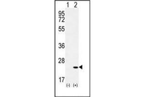 Western blot analysis of CRH (arrow) using Corticoliberin Antibody (C-term) Cat. (CRH anticorps  (C-Term))