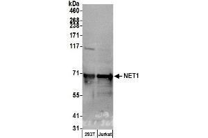 Western Blotting (WB) image for anti-Neuroepithelial Cell Transforming 1 (NET1) (AA 546-596) antibody (ABIN7450485)