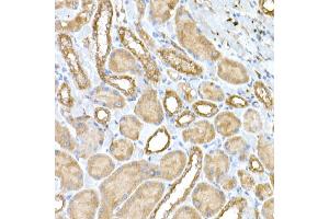 Immunohistochemistry of paraffin-embedded rat kidney using NPHP1 Rabbit pAb (ABIN6128349, ABIN6144768, ABIN6144769 and ABIN6222377) at dilution of 1:50 (40x lens). (NPHP1 anticorps  (AA 345-614))