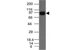 Western blot of A549 cell lysate using UACA antibody (AE-5)