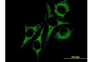 Immunofluorescence of purified MaxPab antibody to HSPD1 on HeLa cell.