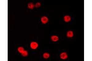 Immunofluorescent analysis of SP1 staining in K562 cells.