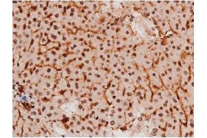 ABIN6267502 at 1/200 staining Mouse liver tissue sections by IHC-P.