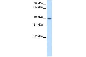 ITGB1BP2 antibody used at 2. (ITGB1BP2 anticorps)
