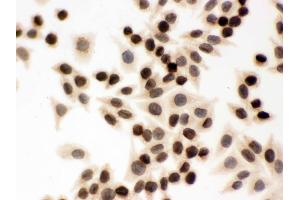 IHC analysis of Lamin B1 using anti-Lamin B1 antibody .