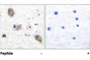 Immunohistochemical analysis of paraffin-embedded human brain tissue using LYN polyclonal antibody . (CD180 anticorps)