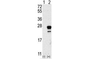 Western blot analysis of NRAS antibody and 293 cell lysate either nontransfected (Lane 1) or transiently transfected with the NRAS gene (2).