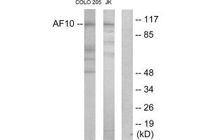 Western blot analysis of extracts from COLO205 cells and Jurkat cells, using AF10 antibody. (MLLT10 anticorps  (Internal Region))