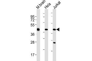 All lanes : Anti-GLUL Antibody (N-term) at 1:2000 dilution Lane 1: mouse brain lysates Lane 2: Hela whole cell lysates Lane 3: Jurkat whole cell lysates Lysates/proteins at 20 μg per lane. (GLUL anticorps  (N-Term))