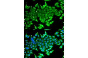 Immunofluorescence analysis of A549 cells using TTF2 antibody. (TTF2 anticorps)