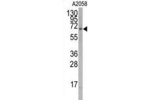 Western Blotting (WB) image for anti-RAR-Related Orphan Receptor A (RORA) antibody (ABIN2995882) (RORA anticorps)