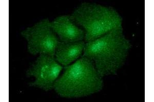 ICC/IF analysis of BMP2 in Hep3B cells line, stained with monoclonal anti-human BMP2 antibody (1:100) with goat anti-mouse IgG-Alexa fluor 488 conjugate (Green).