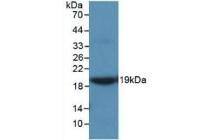 Detection of Recombinant MMP9, Rat using Monoclonal Antibody to Matrix Metalloproteinase 9 (MMP9)