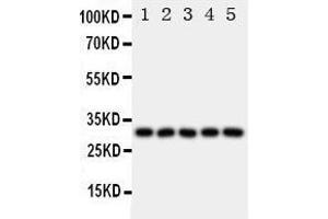 Anti-LOX 1 antibody, Western blotting All lanes: Anti LOX 1  at 0. (OLR1 anticorps  (N-Term))
