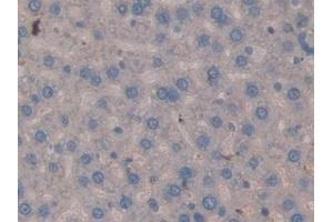 Detection of MMP3 in Rat Liver Tissue using Polyclonal Antibody to Matrix Metalloproteinase 3 (MMP3)
