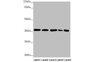 Western blot All lanes: GNB2 antibody at 2.