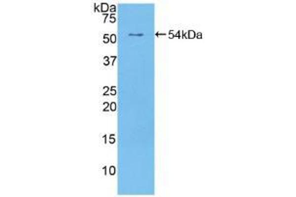 EGFR2 anticorps  (AA 376-578)