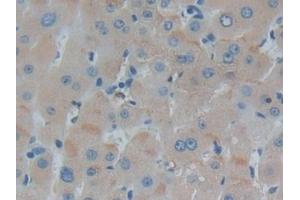 Detection of IFNa/bR1 in Human Liver Tissue using Polyclonal Antibody to Interferon Alpha/Beta Receptor 1 (IFNa/bR1)