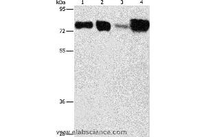 Western blot analysis of Hepg2 and hela cell, human fetal kidney and liver tissue, using ACSL4 Polyclonal Antibody at dilution of 1:650 (ACSL4 anticorps)