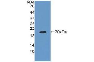 Detection of Recombinant MRPL1, Human using Polyclonal Antibody to Mitochondrial Ribosomal Protein L1 (MRPL1)