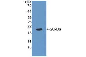 Detection of Recombinant MRPL1, Human using Polyclonal Antibody to Mitochondrial Ribosomal Protein L1 (MRPL1) (MRPL1 anticorps  (AA 147-285))