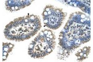 Image no. 1 for anti-Sonic Hedgehog (SHH) (N-Term) antibody (ABIN6736667) (Sonic Hedgehog anticorps  (N-Term))