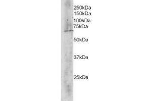 Image no. 1 for anti-Transducin (Beta)-Like 1X-Linked (TBL1X) (C-Term) antibody (ABIN374165) (TBL1X anticorps  (C-Term))
