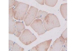 Figure. (TNNI2 anticorps  (AA 1-182))