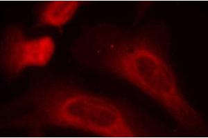 Immunofluorescence analysis of methanol-fixed HeLa cells using Phospho-STAT1(S727) Polyclonal Antibody (STAT1 anticorps  (pSer727))