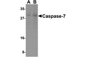 Western Blotting (WB) image for anti-Caspase 7, Apoptosis-Related Cysteine Peptidase (CASP7) (N-Term) antibody (ABIN1031300) (Caspase 7 anticorps  (N-Term))