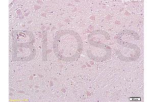 Formalin-fixed and paraffin embedded: rat brain tissue labeled with Anti-MAP1A Polyclonal Antibody (ABIN735308), Unconjugated at 1:200, followed by conjugation to the secondary antibody and DAB staining (MAP1A anticorps  (AA 2651-2750))