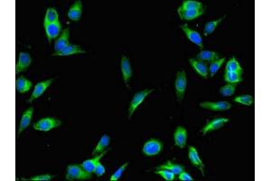 Immunofluorescent analysis of Hela cells using ABIN7168833 at dilution of 1:100 and Alexa Fluor 488-congugated AffiniPure Goat Anti-Rabbit IgG(H+L) (SENP1 anticorps  (AA 63-214))