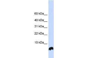 WB Suggested Anti-GLRX Antibody Titration: 0. (Glutaredoxin 1 anticorps  (N-Term))