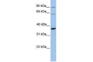 WB Suggested Anti-SLAMF6 Antibody Titration:  0. (SLAMF6 anticorps  (N-Term))