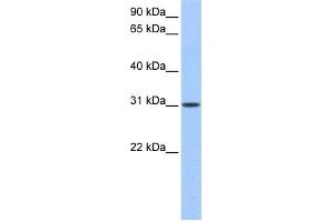 WB Suggested Anti-HUS1B Antibody Titration: 0. (HUS1B anticorps  (N-Term))